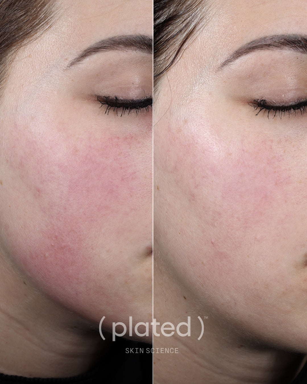 (plated) DAILY Serum