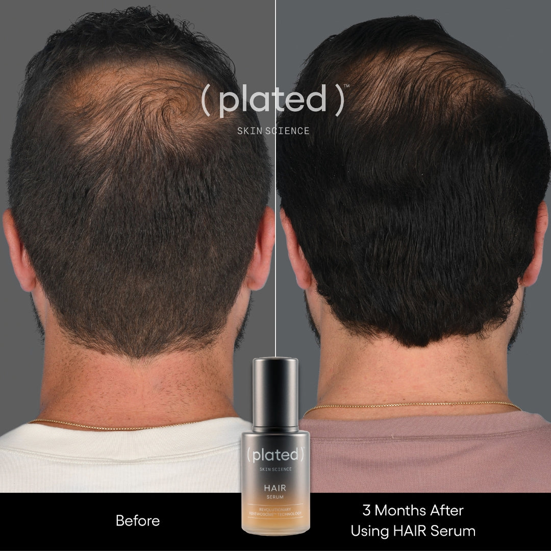 (plated) HAIR Serum
