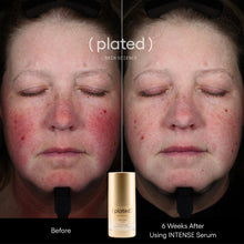 Load image into Gallery viewer, (plated) INTENSE Serum
